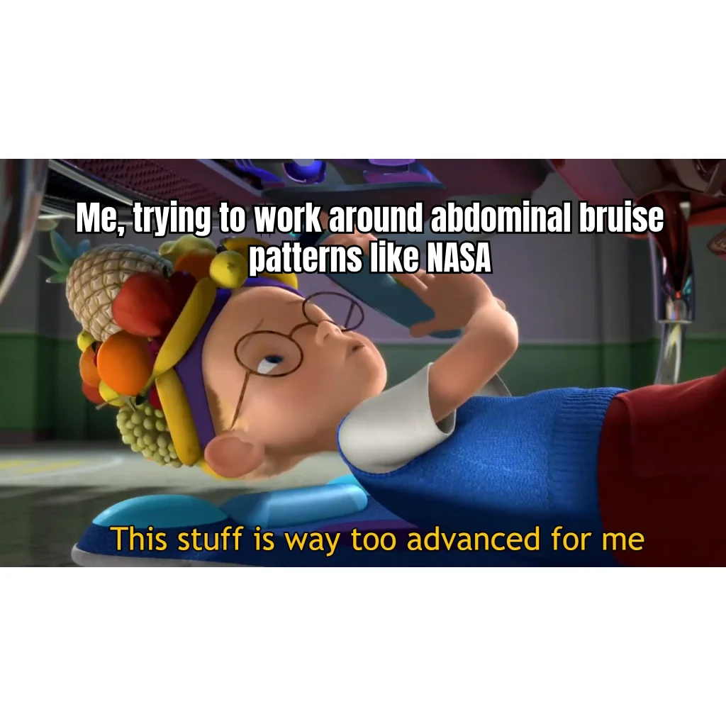 Subcutaneous Constellation Mapping — Massage therapist encounters the Orion's Belt of injection bruises and silently recalibrates the entire session plan.